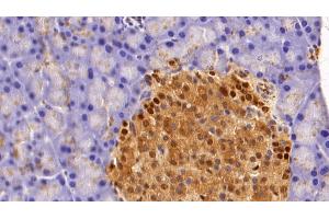 Immunohistochemistry (IHC) image for anti-Glyceraldehyde-3-Phosphate Dehydrogenase (GAPDH) (AA 2-148) antibody (ABIN7428953)