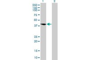 Western Blotting (WB) image for anti-Fc Fragment of IgE, Low Affinity II, Receptor For (CD23) (FCER2) (AA 1-321) antibody (ABIN515556)