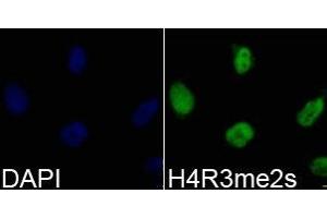 Immunofluorescence analysis of 293T cell using H4R3me2s antibody. (Histone 3 抗体  (2meArg3))