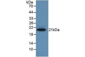 Detection of Recombinant CBG, Rat using Monoclonal Antibody to Corticosteroid Binding Globulin (CBG) (SERPINA6 抗体  (AA 173-344))