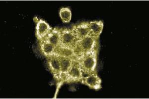 Immunofluorescence staining of A431 cells (human epithelial carcinoma, ATCC CRL-1555). (AKAP9 抗体  (AA 17-130))