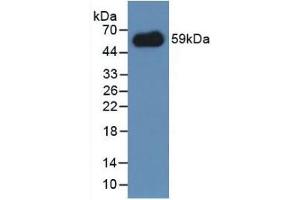 Detection of Recombinant IREM1, Mouse using Polyclonal Antibody to Immune Receptor Expressed On Myeloid Cells 1 (IREM1) (IREM1 抗体  (AA 45-310))
