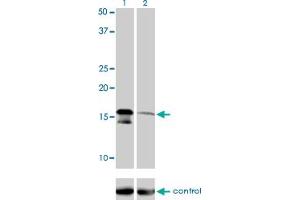 Western blot analysis of AGTRAP over-expressed 293 cell line, cotransfected with AGTRAP Validated Chimera RNAi (Lane 2) or non-transfected control (Lane 1). (AGTRAP 抗体  (AA 108-159))