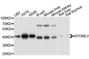 Western blot analysis of extracts of various cell lines, using STOML2 antibody.