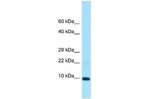 WB Suggested Anti-LSM5 Antibody Titration: 1. (LSM5 抗体  (Middle Region))
