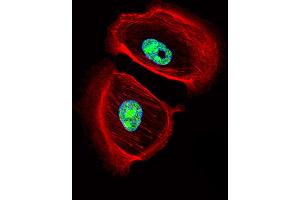 Fluorescent confocal image of SK-BR-3 cell stained with ARNT2 Antibody . (ARNT2 抗体  (AA 249-278))