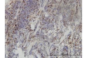 Immunostaining (ISt) image for anti-Methylenetetrahydrofolate Dehydrogenase (NADP+ Dependent) 2, Methenyltetrahydrofolate Cyclohydrolase (MTHFD2) (AA 16-344) antibody (ABIN564706)