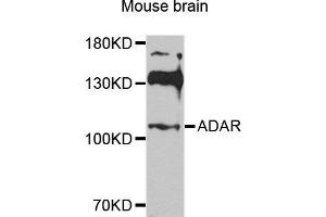 Western blot analysis of extracts of various cell lines, using ADAR antibody. (ADAR 抗体  (AA 150-250))