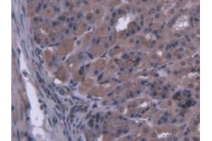IHC-P analysis of Mouse Stomach Tissue, with DAB staining. (MARS 抗体  (AA 74-212))