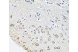 Immunohistochemistry of paraffin-embedded Mouse brain using PUM1 Polyclonal Antibody at dilution of 1:100 (40x lens). (PUM1 抗体)