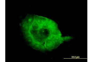 Immunofluorescence of monoclonal antibody to SH3BP2 on A-431 cell. (SH3BP2 抗体  (AA 452-561))