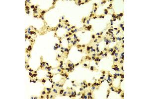 Immunohistochemistry of paraffin-embedded Mouse lung using TriMethyl-Histone H3-K9 antibody. (Histone 3 抗体  (H3K9me3))