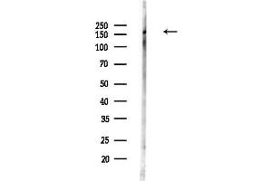 anti-TBC1 Domain Family, Member 4 (TBC1D4) (pSer318) antibody