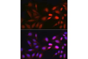 Immunofluorescence analysis of U2OS cells using EGR1 Rabbit pAb (ABIN3016527, ABIN3016528, ABIN3016529 and ABIN1679679) at dilution of 1:250 (40x lens). (EGR1 抗体)