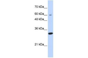 WB Suggested Anti-LRRC57 Antibody Titration: 0. (LRRC57 抗体  (N-Term))