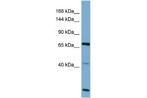 Host:  Rabbit  Target Name:  OCA2  Sample Type:  OVCAR-3 Whole cell lysates  Antibody Dilution:  1. (OCA2 抗体  (C-Term))