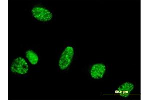 Immunofluorescence of monoclonal antibody to PPIG on HeLa cell. (PPIG 抗体  (AA 13-106))