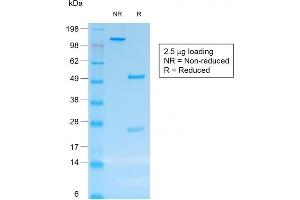 SDS-PAGE Analysis Purified CD30 Mouse Recombinant Monoclonal Antibody (rCD30/412).