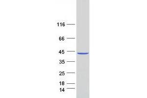 Western Blotting (WB) image for Methionine Adenosyltransferase II, beta (MAT2B) (Transcript Variant 1) protein (Myc-DYKDDDDK Tag) (ABIN2725547)