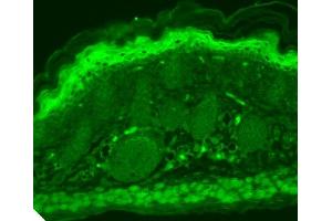 Immunohistochemistry (IHC) image for anti-Transient Receptor Potential Cation Channel, Subfamily V, Member 3 (TRPV3) (AA 774-791) antibody (ABIN361778)