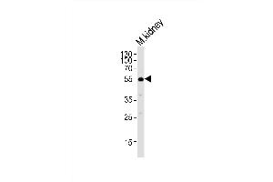 Western Blotting (WB) image for anti-Nucleus Accumbens Associated 1, BEN and BTB (POZ) Domain Containing (NACC1) (AA 324-358) antibody (ABIN6243841)