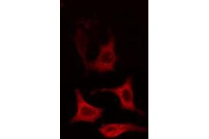 Immunofluorescence (fixed cells) (IF/ICC) image for anti-Cytochrome P450, Family 2, Subfamily R, Polypeptide 1 (CYP2R1) (Internal Region) antibody (ABIN6258067)