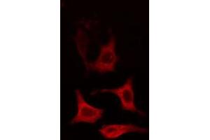 ABIN6274651 staining HT29 cells by IF/ICC. (CYP2R1 抗体  (Internal Region))
