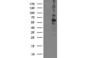 Western Blotting (WB) image for anti-Protein Phosphatase, Mg2+/Mn2+ Dependent, 1B (PPM1B) antibody (ABIN1500376) (PPM1B 抗体)