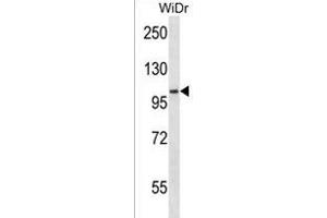 SDCCAG1 Antibody (N-term) (ABIN1539209 and ABIN2850179) western blot analysis in WiDr cell line lysates (35 μg/lane).