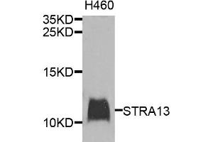 Western blot analysis of extracts of H460 cells, using STRA13 antibody. (STRA13 抗体)