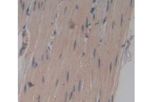 IHC-P analysis of Human Tissue, with DAB staining. (TNNT1 抗体  (AA 1-259))