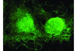 Image no. 3 for anti-Vezatin, Adherens Junctions Transmembrane Protein (VEZT) antibody (ABIN347059) (VEZT 抗体)