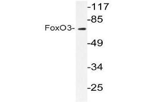 Western blot (WB) analyzes of FoxO3 antibody in extracts from COLO205 cells. (FOXO3 抗体)