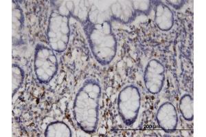 Immunoperoxidase of monoclonal antibody to NME6 on formalin-fixed paraffin-embedded human small Intestine. (NME6 抗体  (AA 1-194))
