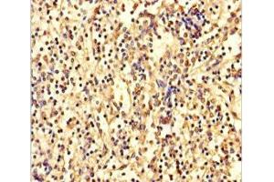 Immunohistochemistry of paraffin-embedded human spleen tissue using ABIN7144155 at dilution of 1:100 (ANKDD1A 抗体  (AA 272-490))
