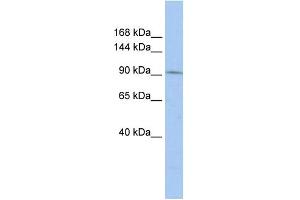 Western Blotting (WB) image for anti-TAF3 RNA Polymerase II, TATA Box Binding Protein (TBP)-Associated Factor, 140kDa (TAF3) (Middle Region) antibody (ABIN2784481)