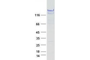 Validation with Western Blot