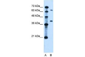 LRRC26 antibody used at 0. (LRRC26 抗体  (Middle Region))