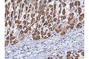 Immunohistochemistry (IHC) image for anti-Electron-Transfer-Flavoprotein, alpha Polypeptide (ETFA) (Center) antibody (ABIN2856049)