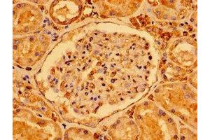 Immunohistochemistry of paraffin-embedded human kidney tissue using ABIN7170894 at dilution of 1:100 (SDHAF1 抗体  (AA 78-115))