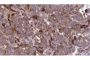 Immunohistochemistry (IHC) image for anti-ATPase, Na+/K+ Transporting, beta 1 Polypeptide (ATP1B1) (Internal Region) antibody (ABIN6260120)