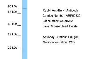 Western Blotting (WB) image for anti-BR Serine/threonine Kinase 1 (BRSK1) (C-Term) antibody (ABIN2788234) (BRSK1 抗体  (C-Term))