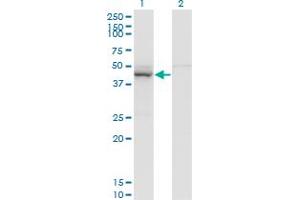 Western Blot analysis of TARBP2 expression in transfected 293T cell line by TARBP2 monoclonal antibody (M04), clone 2G10. (TARBP2 抗体  (AA 141-250))