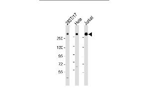 All lanes : Anti-IGF2R Antibody (C-Term) at 1:2000 dilution Lane 1: 293T/17 whole cell lysate Lane 2: Hela whole cell lysate Lane 3: Jurkat whole cell lysate Lysates/proteins at 20 μg per lane. (IGF2R 抗体  (AA 2424-2458))