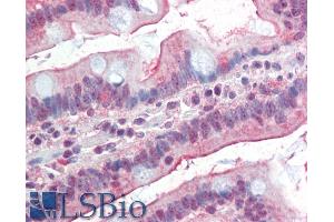 ABIN1590010 (5µg/ml) staining of paraffin embedded Human Small Intestine. (DGAT1 抗体  (AA 67-79))