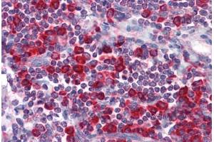 Human Tonsil: Formalin-Fixed, Paraffin-Embedded (FFPE) (MTDH 抗体)