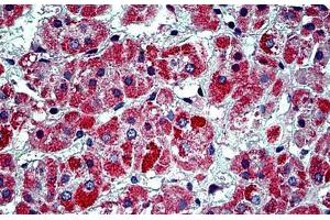 Human Adrenal: Formalin-Fixed, Paraffin-Embedded (FFPE) (Prohibitin 2 抗体  (Tyr128))