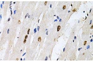 Immunohistochemistry of paraffin-embedded Rat heart using KPNA4 Polyclonal Antibody at dilution of 1:200 (40x lens). (KPNA4 抗体)