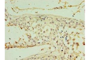 Immunohistochemistry of paraffin-embedded human testis tissue using ABIN7167041 at dilution of 1:100 (RDM1 抗体  (AA 125-284))