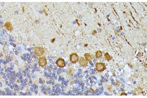 Immunohistochemistry of paraffin-embedded Mouse cerebellum using ELP3 Polyclonal Antibody at dilution of 1:100 (40x lens). (ELP3/KAT9 抗体)